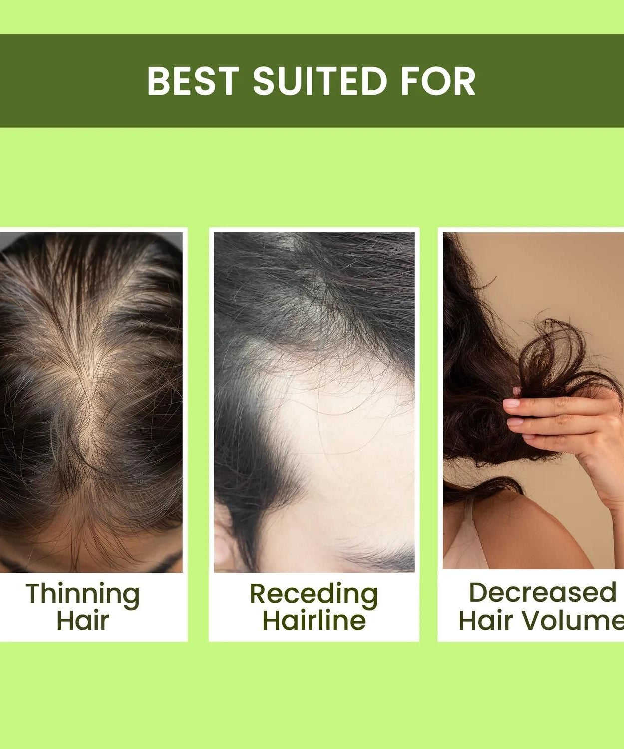 Rosemary Water, Hair Spray For Regrowth Buy 1 Get 2 Free